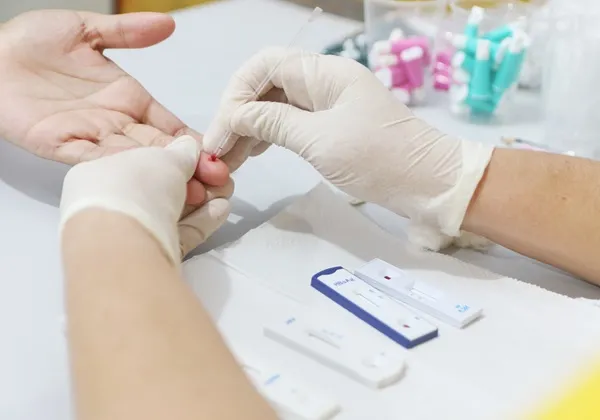Fiocruz Bahia lança estudo sobre prevenção do HIV entre jovens em áreas periféricas